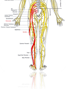 Spinal Decompression and Neuropathy